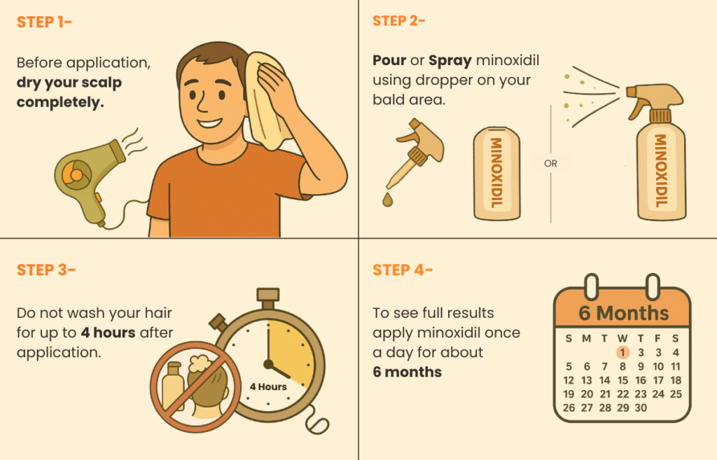 Step-by-step guide to applying Minoxidil for hair regrowth – dry scalp completely, apply Minoxidil via dropper or spray on bald area, avoid washing hair for 4 hours, and use daily for 6 months. Effective hair fall treatment and baldness solution for men using affordable Jan Aushadhi Minoxidil.