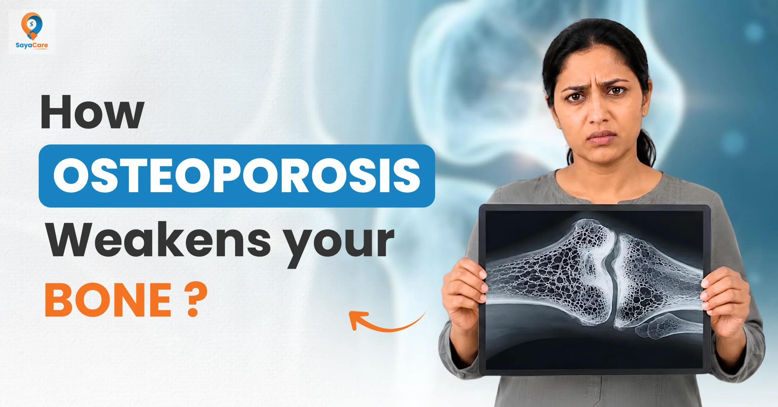 osteoporosis